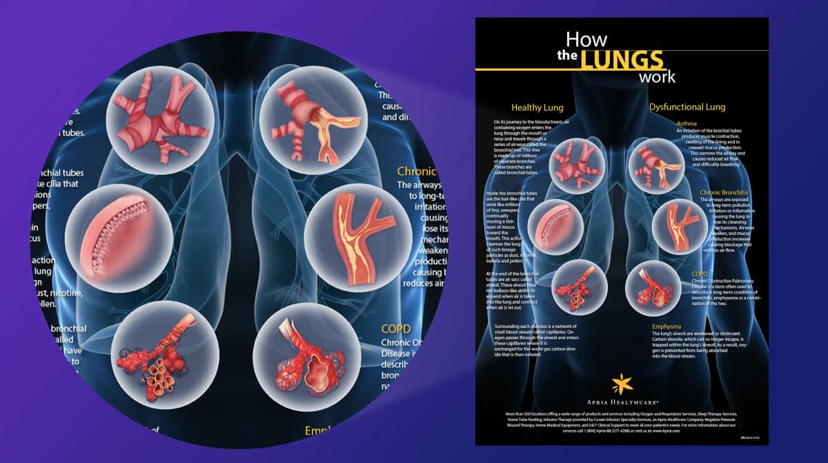 Lung Educational Poster - Medical Illustration project by Jonathan Good